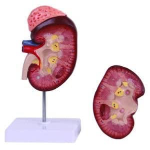 NAUDH Kidney With Adrenal Gland Model Imported
